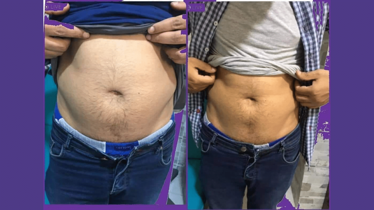 تفتيت الدهون في الغردقة